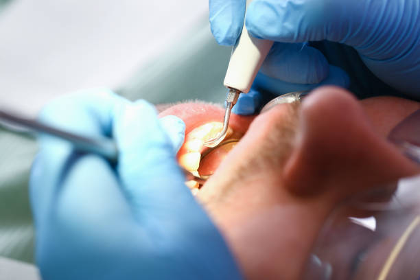 Best Emergency Denture Repair in Baiting Hollow, NY